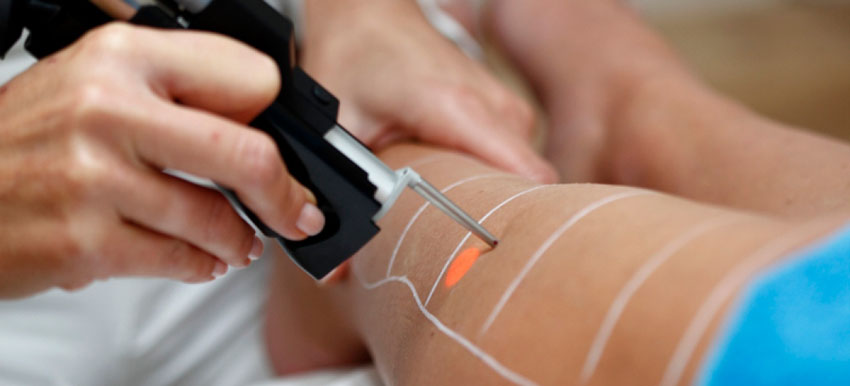 epilation-laser-turquie