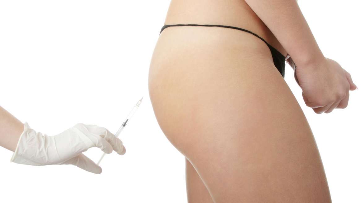 Les injections de Sculptra pour des fesses galbées et rebondies sans chirurgie