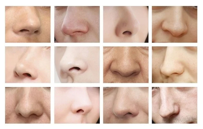 Quels sont les différents types et formes du nez ?