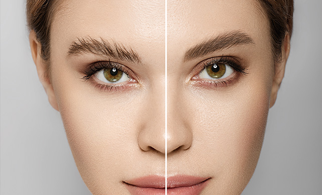 The Grand Comparison: Eyebrow Transplant Costs in Saudi Arabia vs Turkey