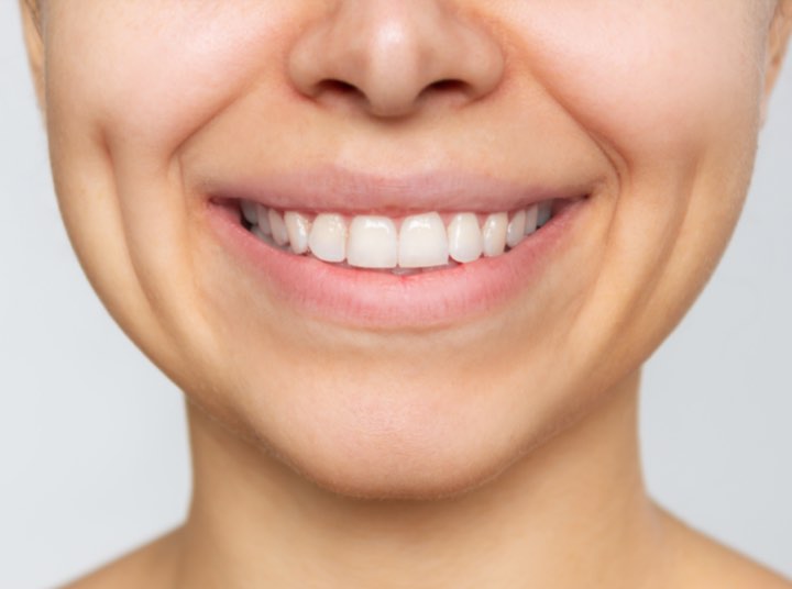 Comprehensive Comparison of Dimpleplasty Procedure Costs in Dubai vs. Turkey