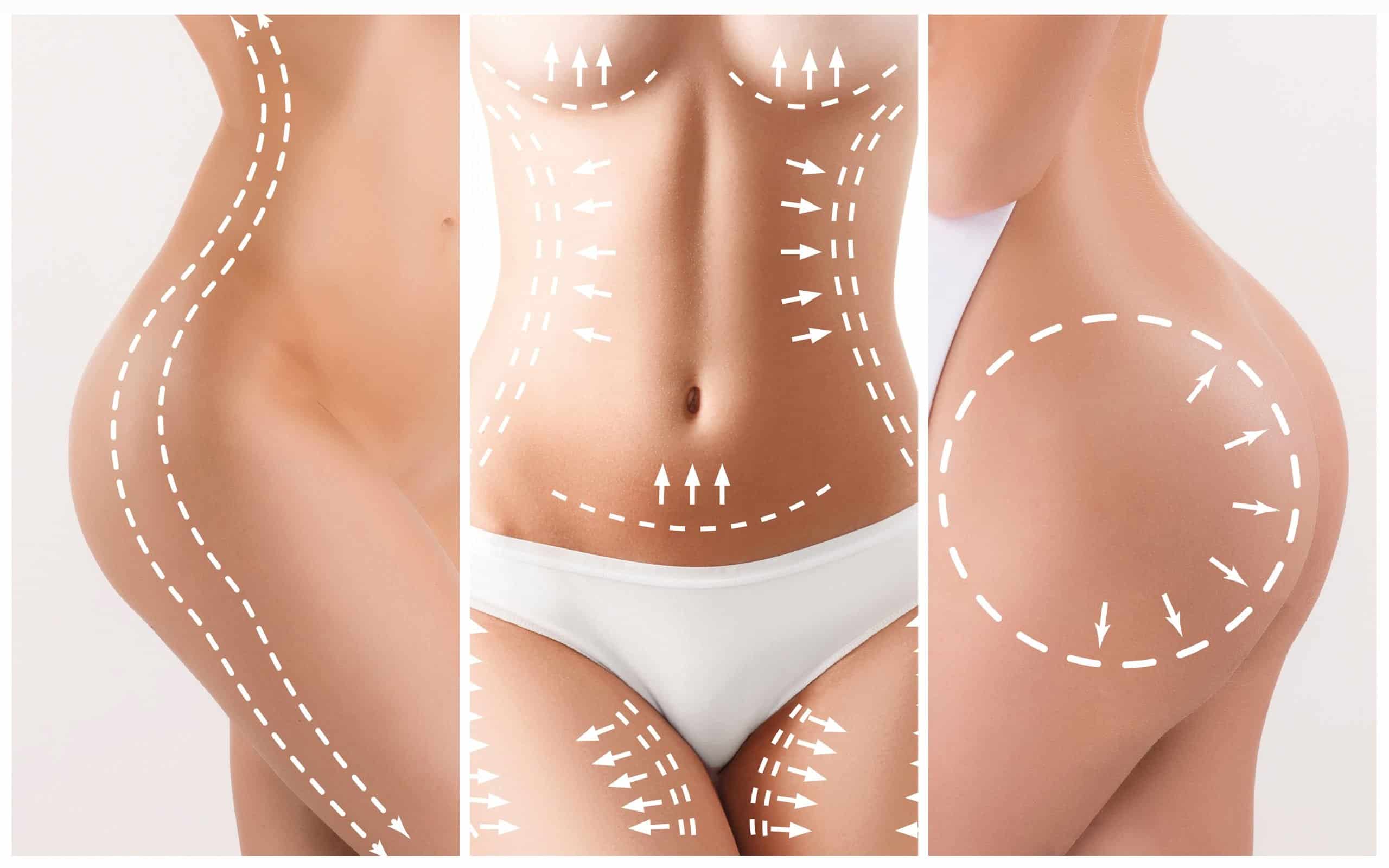 Comprehensive Guide to the Cost of Mommy Makeover Procedure in Turkey.