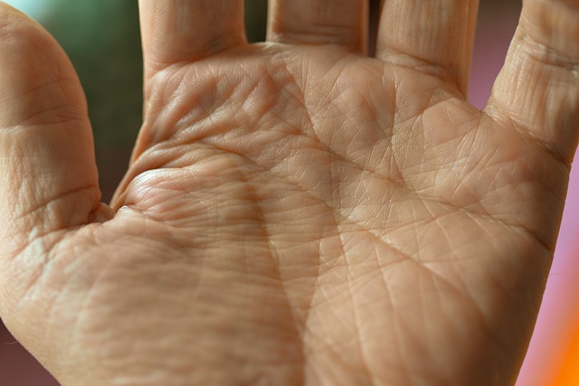 Rewrite Your Destiny: The Comprehensive Guide to Palm Line Surgery in Dubai.