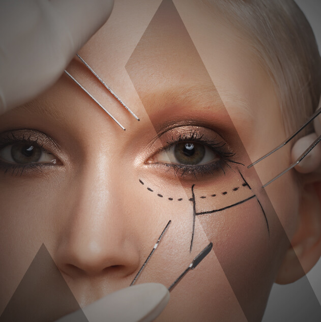 facelift-Turkey