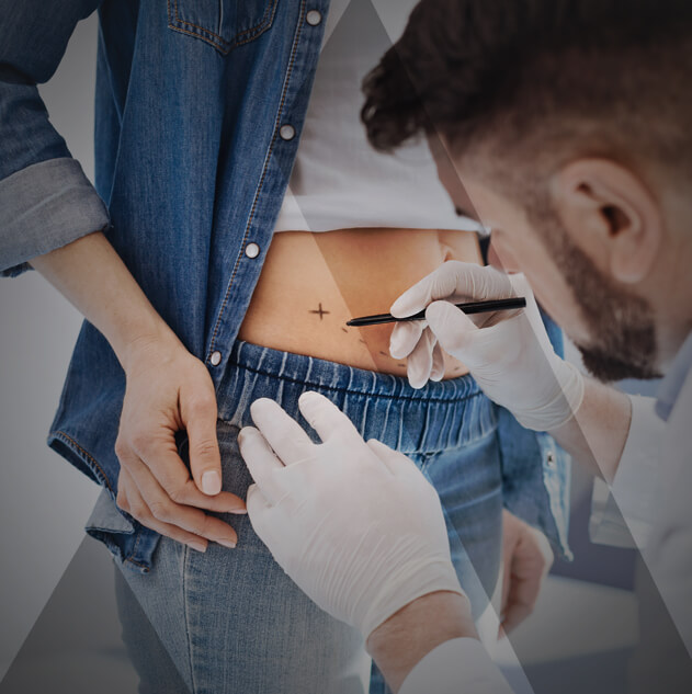 abdominoplasty-turkey