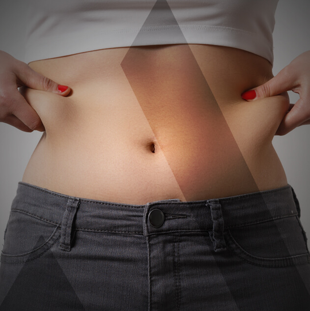 abdominoplasty-turkey