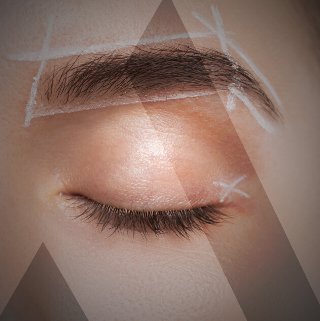eyebrow-transplant-Turkey