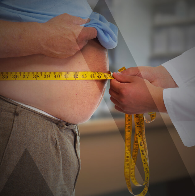 gastric-sleeve-turkey