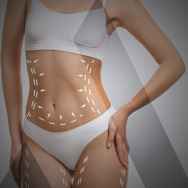 liposuction-turkey