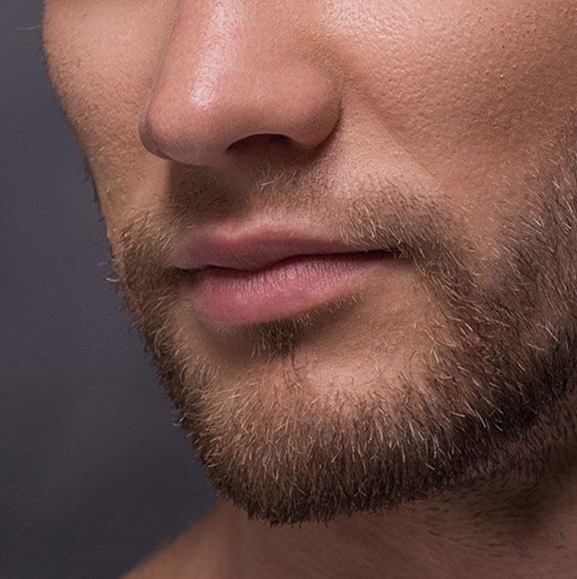 trous-barbe