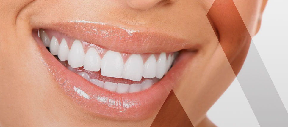 smile-infinity-prix-turquie